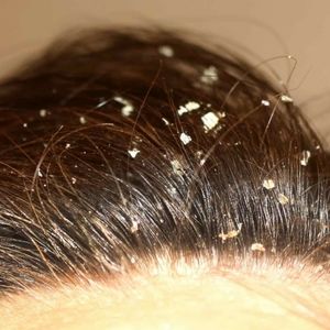 Tea Tree Shampoo & Conditioner